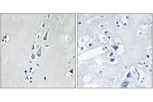Immunohistochemistry analysis of paraffin-embedded human brain, using CaMK2 (Phospho-Thr286) Antibody. (CAMK2B Antikörper  (pThr286))