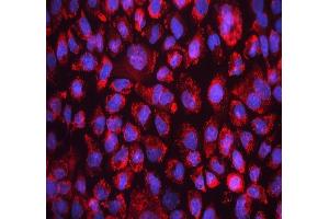 IF analysis of FACL4/ACSL4 using anti-FACL4/ACSL4 antibody (ABIN7602756). (ACSL4 Antikörper  (C-Term))