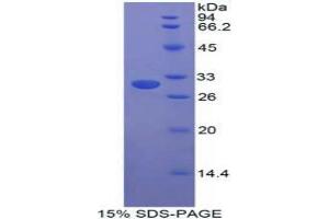 SDS-PAGE analysis of Human STAM Binding Protein. (STAMBP Protein)