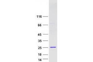 Western Blotting (WB) image for Interferon, alpha 10 (IFNa10) protein (Myc-DYKDDDDK Tag) (ABIN2723311)