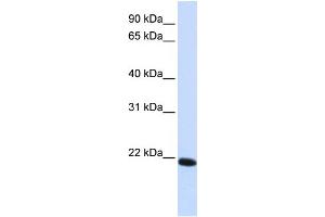 WB Suggested Anti-CLDN19 Antibody Titration:  0. (Claudin 19 Antikörper  (C-Term))