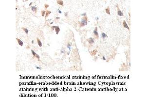 Image no. 1 for anti-Catenin (Cadherin-Associated Protein), alpha 2 (CTNNA2) antibody (ABIN791201) (CTNNA2 Antikörper)