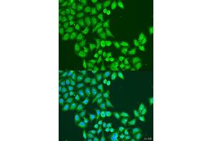 Immunofluorescence analysis of U2OS cells using STAT5A antibody (ABIN2737605) at dilution of 1:100. (STAT5A Antikörper)