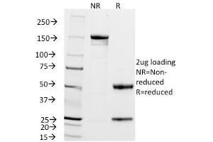 SDS-PAGE Analysis Purified ZAP70 Mouse Monoclonal Antibody (2F3. (ZAP70 Antikörper  (AA 1-254))