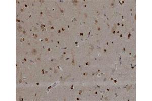 ABIN6266498 at 1/200 staining human brain tissue sections by IHC-P. (NOL3 Antikörper  (C-Term))