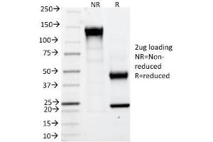SDS-PAGE Analysis Purified CAIX Mouse Monoclonal Antibody (CA9/781). (CA9 Antikörper)