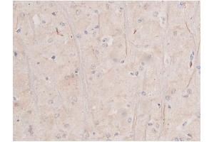 ABIN6255994 and ABIN6267364 at 1/200 staining Rat brain tissue sections by IHC-P. (KIT Antikörper  (pTyr703))