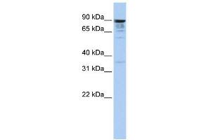 MCTP1 antibody used at 1 ug/ml to detect target protein. (MCTP1 Antikörper  (Middle Region))