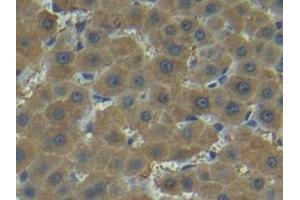 Immunohistochemistry (IHC) image for anti-Matrix Metallopeptidase 7 (Matrilysin, Uterine) (MMP7) (AA 1-267) antibody (ABIN7431020)