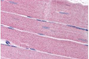 Human Skeletal Muscle (formalin-fixed, paraffin-embedded) stained with SORBS1 antibody ABIN297694 at 2. (SORBS1 Antikörper  (AA 1282-1294))