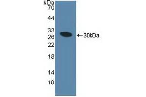 Detection of Recombinant MIB1, Human using Polyclonal Antibody to Mindbomb Homolog 1 (MIB1) (MIB1 Antikörper  (AA 769-1000))
