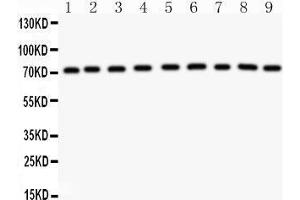 Anti-GHR antibody, Western blotting All lanes: Anti GHR  at 0. (Growth Hormone Receptor Antikörper  (Middle Region))