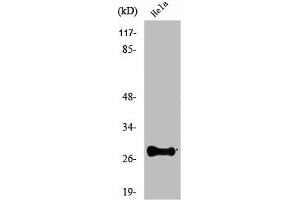 Western Blot analysis of COLO205 cells using Nkx-2. (NKX2-6 Antikörper  (Internal Region))