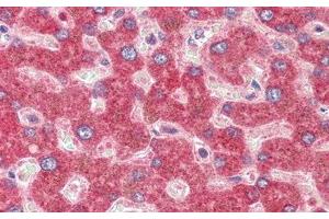 Immunohistochemistry (IHC) image for anti-Glutaminase 2 (Liver, Mitochondrial) (GLS2) (AA 154-479) antibody (ABIN7436594)
