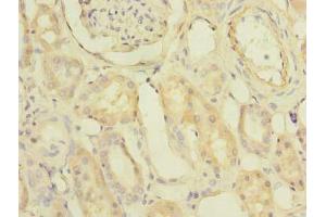 Immunohistochemistry of paraffin-embedded human kidney tissue using ABIN7163092 at dilution of 1:100 (PDCL2 Antikörper  (AA 1-241))