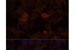 Immunofluorescence (IF) image for anti-Filamin B, beta (FLNB) antibody (ABIN7260435)