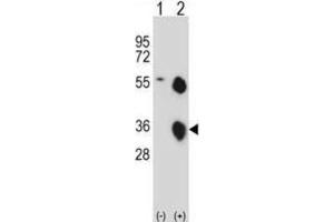 Western Blotting (WB) image for anti-Kallikrein 8 (KLK8) antibody (ABIN2997958) (Kallikrein 8 Antikörper)