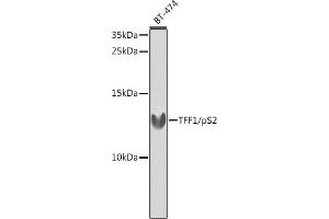 Western blot analysis of extracts of BT-474 cells, using TFF1/pS2 antibody (ABIN3015565, ABIN3015566, ABIN3015567 and ABIN6218896) at 1:1000 dilution. (TFF1 Antikörper  (pSer2))