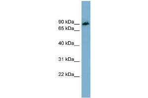 WB Suggested Anti-APBB1IP  Antibody Titration: 0. (Amyloid beta (A4) Precursor Protein-Binding, Family B, Member 1 Interacting Protein (APBB1IP) (N-Term) Antikörper)
