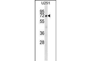 Western blot analysis in U251 cell line lysates (35ug/lane). (MKKS Antikörper  (C-Term))