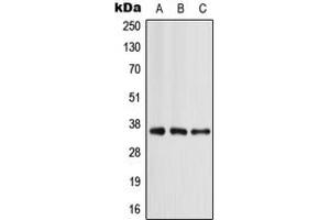 Western blot analysis of Apolipoprotein E expression in MCF7 (A), mouse liver (B), rat liver (C) whole cell lysates. (APOE Antikörper  (Center))