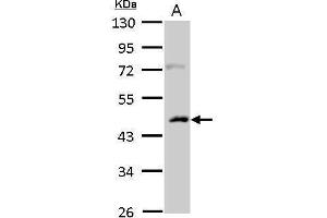 WB Image Casein Kinase 1 alpha 1L antibody detects CSNK1A1L protein by Western blot analysis. (CSNK1A1L Antikörper)