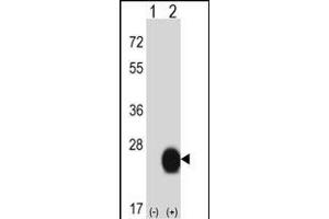 Western blot analysis of CSRP2 (arrow) using rabbit polyclonal CSRP2 Antibody (Center) (ABIN657989 and ABIN2846936).