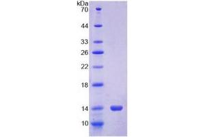 SDS-PAGE analysis of Cow S100A12 Protein. (S100A12 Protein)