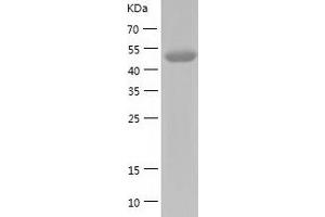 Western Blotting (WB) image for Homogentisate 1,2-Dioxygenase (HGD) (AA 1-445) protein (His tag) (ABIN7288224) (HGD Protein (AA 1-445) (His tag))