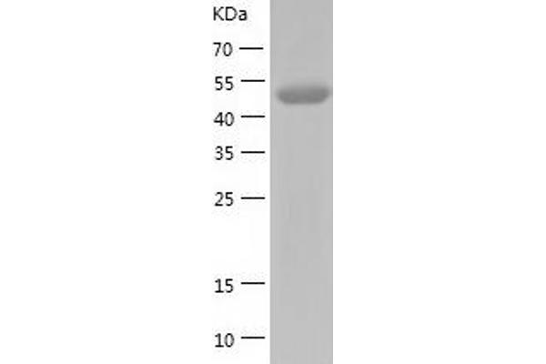 HGD Protein (AA 1-445) (His tag)