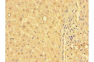 Immunohistochemistry of paraffin-embedded human liver tissue using ABIN7154103 at dilution of 1:100 (GSTM1 Antikörper  (AA 24-156))