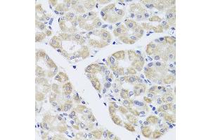 Immunohistochemistry of paraffin-embedded human stomach using DISC1 antibody at dilution of 1:100 (x40 lens). (DISC1 Antikörper)