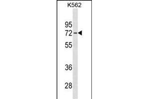 Western Blotting (WB) image for anti-Interleukin 22 Receptor, alpha 1 (IL22RA1) (AA 408-436), (C-Term) antibody (ABIN1537292)