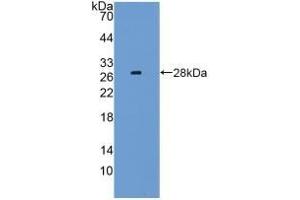 Detection of Recombinant LAG3, Mouse using Polyclonal Antibody to Lymphocyte Activation Gene 3 (LAG3) (LAG3 Antikörper  (AA 274-504))