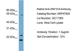 WB Suggested Anti-ZNF37A  Antibody Titration: 0. (ZNF37A Antikörper  (Middle Region))