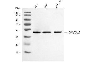 Western blot analysis of SH2D4A using anti-SH2D4A antibody (ABIN7601695).