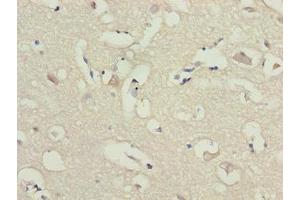 Immunohistochemistry of paraffin-embedded human brain tissue using ABIN7143514 at dilution of 1:100 (ARL6IP1 Antikörper  (AA 93-133))