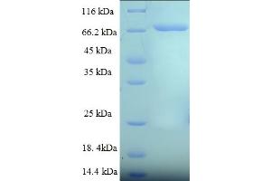 SDS-PAGE (SDS) image for Cytoplasmic Polyadenylation Element Binding Protein 1 (CPEB1) (AA 1-486), (full length) protein (His-SUMO Tag) (ABIN4975611) (CPEB1 Protein (AA 1-486, full length) (His-SUMO Tag))