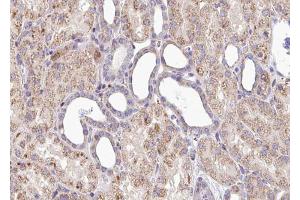 ABIN6267539 at 1/100 staining human Kidney tissue sections by IHC-P. (SOX9 Antikörper  (pSer181))