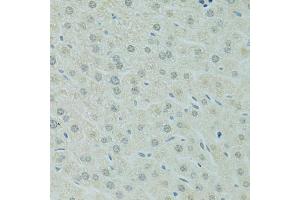 Immunohistochemistry of paraffin-embedded mouse liver using RCC1 antibody (ABIN5973761) at dilution of 1/100 (40x lens). (RCC1 Antikörper)