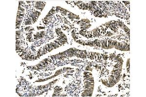 IHC analysis of EHMT2/G9A using anti-EHMT2/G9A antibody (ABIN7602084). (EHMT2 Antikörper  (AA 580-1195))