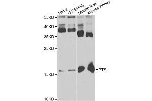 Western blot analysis of extracts of various cell lines, using PTS antibody.