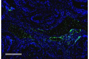 Immunohistochemistry analysis using Mouse Anti-VPS35 Monoclonal Antibody, Clone 10A8 (ABIN6932992). (VPS35 Antikörper  (Biotin))