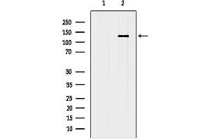 Western blot analysis of lysates from 3, using Integrin alpha E Antibody.