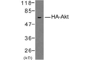 Image no. 1 for anti-HA-Tag antibody (ABIN319423) (HA-Tag Antikörper)