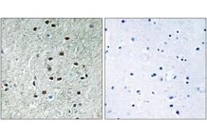 Immunohistochemistry analysis of paraffin-embedded human brain, using REXO1 Antibody. (REXO1 Antikörper  (AA 185-234))