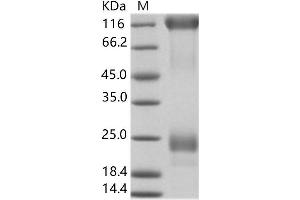 Zaire Ebola Virus Envelope Glycoprotein (ZEBOV GP) protein (His tag)