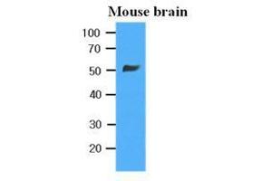 Western Blotting (WB) image for anti-Tubulin, beta 2B (TUBB2B) antibody (ABIN567630) (TUBB2B Antikörper)