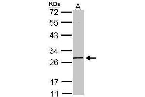 WB Image Sample (30 ug of whole cell lysate) A: A431 , 10% SDS PAGE antibody diluted at 1:1000 (GK5 Antikörper  (Center))