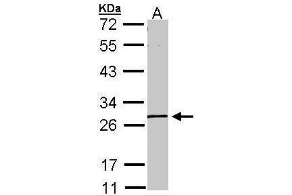 GK5 Antikörper  (Center)